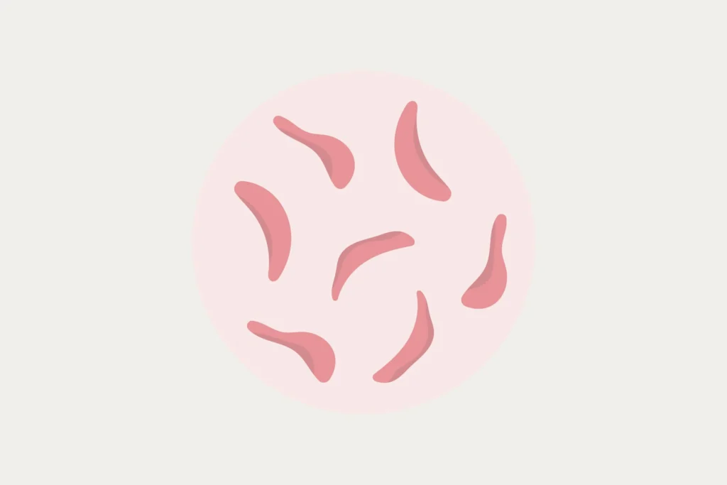 Sickle Cell Anemia: Rapid-Fire Basics Explained