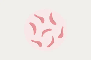 Sickle Cell Anemia: Rapid-Fire Basics Explained
